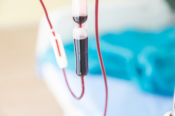 Closeup view of drip chamber for an intravenous infusion set in hospital for blood transfer in...