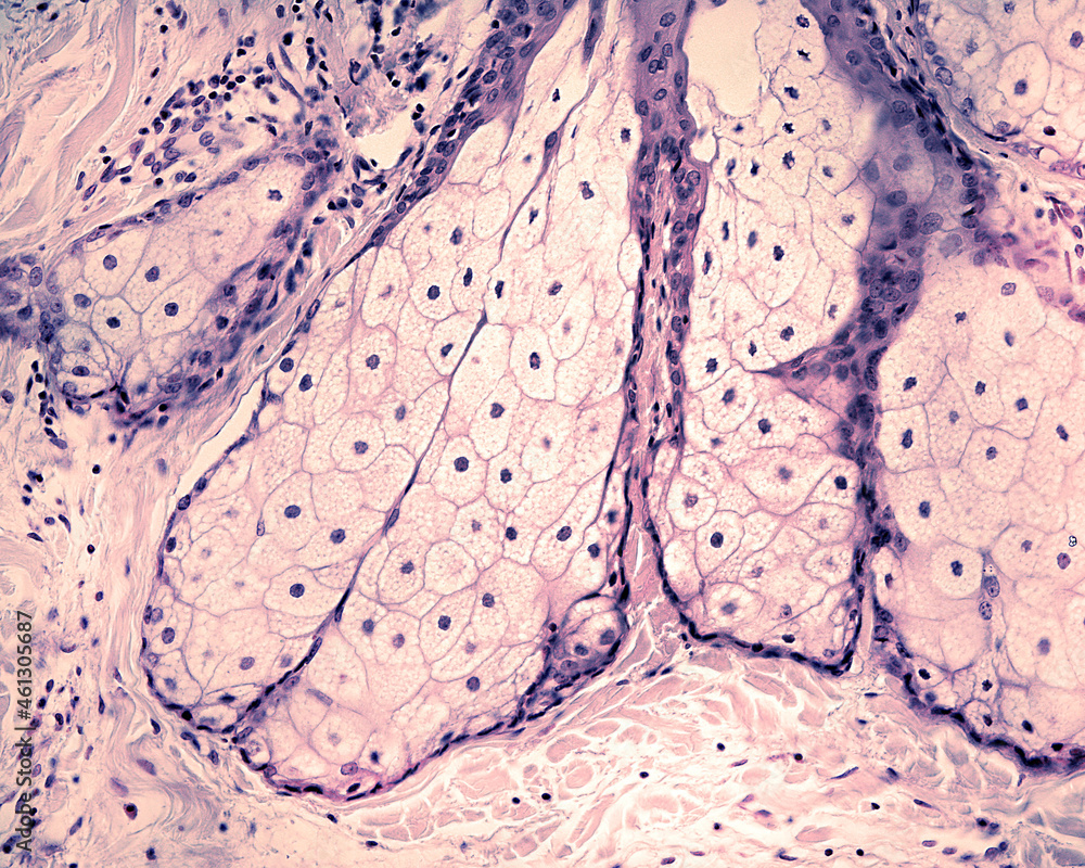 Poster Human skin. Sebaceous gland