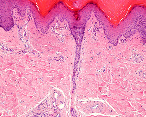 Human eccrine sweat gland. Excretory duct