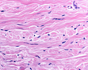 Reticular dermis. Human skin