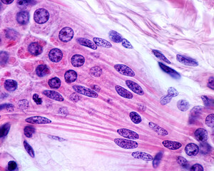 Apocrine sweat gland.Myoepithelial cells