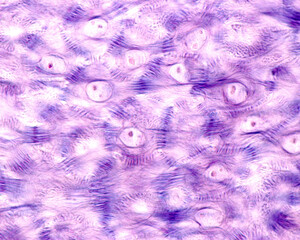 Epidermis. Stratum spinosum. Desmosomes