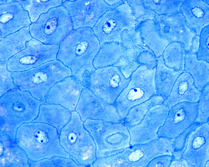Epidermis. Stratum spinosum. Desmosomes