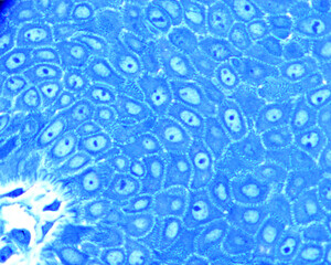 Epidermis. Stratum spinosum. Desmosomes
