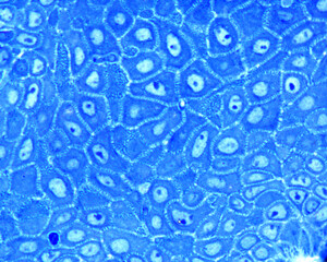 Epidermis. Stratum spinosum. Desmosomes
