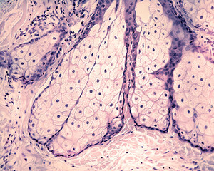 Human skin. Sebaceous gland