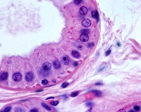 Apocrine sweat gland. Columnar epithelium