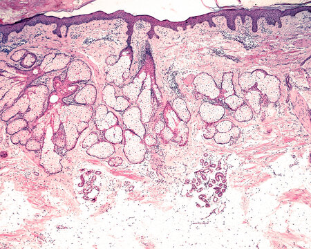 Location of the skin glands