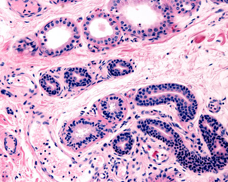 Comparison between eccrine and apocrine sweat glands