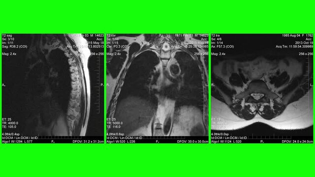 MRI , Magnetic resonance images of human body parts, green background for transparency.