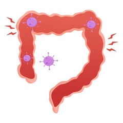 Vector illustration of a bad colon, suitable for advertising health and education products