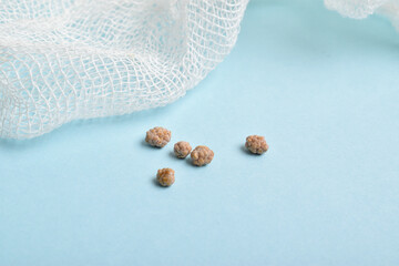 The cut stones in the gallbladder lie on the gauze. Laparoscopy.