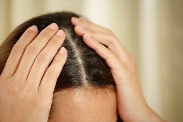 A woman has problems with hair and scalp,she has dandruff from allergic reactions to shampoos. and hair conditioner