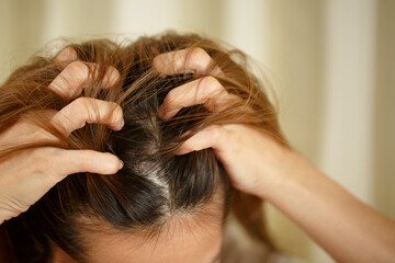 A woman has problems with hair and scalp,she has dandruff from allergic reactions to shampoos. and hair conditioner
