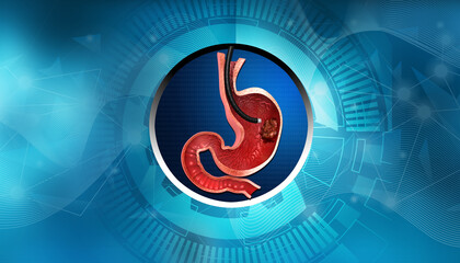 Stomach endoscopy on digital technology background. 3d illustration. - obrazy, fototapety, plakaty