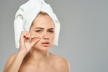 pretty woman bare shoulders acne treatment Studio close-up