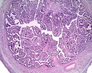 Ampulla of Fallopian tube