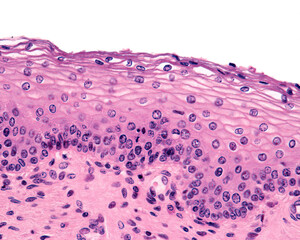 Vagina. Epithelium