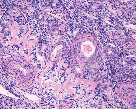 รูปภาพAtresia เลือกดูภาพถ่ายสต็อก เวกเตอร์ และวิดีโอ1,409 Adobe Stock