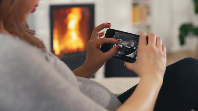 Beautiful pregnant woman with brown hair stitting in front of cosy fireplace stroking baby belly look at ultrasound pictures on smartphone