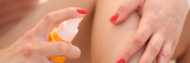 Woman puffing sunscreen spray on skin of her leg closeup