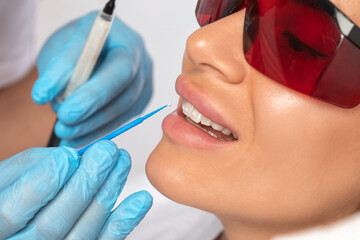 The dentist makes a teeth whitening procedure in the clinic to a young beautiful woman. A healthy...