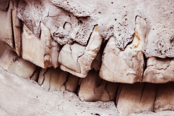 dents sur machoîres