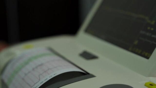 Electronic Cardiotocography Machine Monitoring Fetal Heart Contractions Of Uterus. Printing Cardiogram Report Coming Out Electrocardiogram In Labor Ward During Pregnancy. Medical Diagnostic Equipment