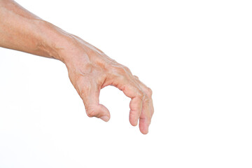 an old man left hand muscle atrophy between a thumb and index finger caused by treatment of gunshot...