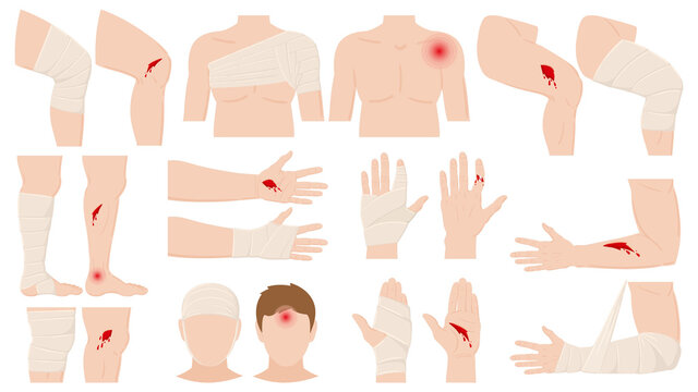 Cartoon physical injury, wound bandage application concept. Open and bandaged human body parts, treated wounds, fractures vector illustration. Human physical injury treatment