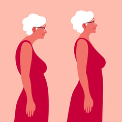 An Elderly woman with a bad posture. Spine. Profile. Kyphosis. Flat vector illustration on red background. Minimalism