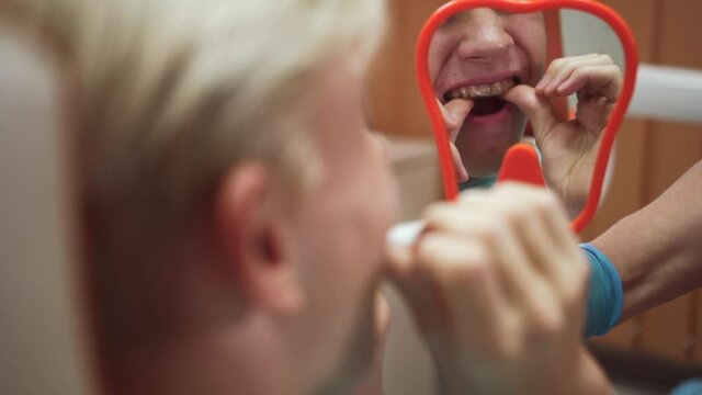 Teenager trying mouthguard and posing during consultation with orthodontist in clinic office spbd. Close-up view of handsome guy inserts transparent model over teeth and looks with smile, shows result