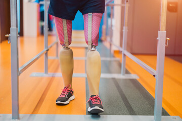 Close up of a woman with prosthetic legs using parallel bars

