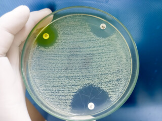Antimicrobial susceptibility testing in culture plate. Drug sensitivity test, disk drug, antibiotic sensitivity