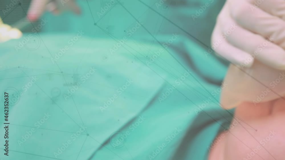 Poster animation of network of connections and data processing over surgeons in operating theater