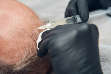Man receiving injection in head in cosmetology clinic