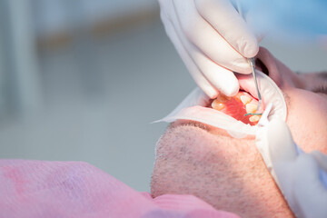 Dental clinic. Doctor dentist treats teeth to the patient in the dental clinic. Dentistry and orthodontist. Dental treatment and bite correction.