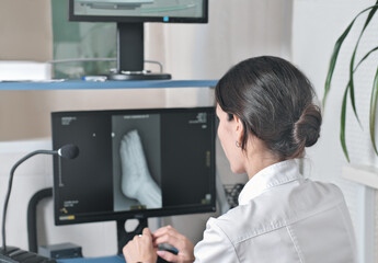 woman radiologist looking at monitor with an x-ray image of a foot. examining and diagnostics of a trauma. rear view of young female x-ray doctor.