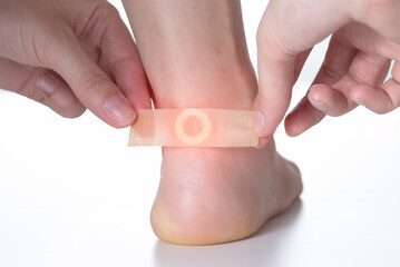 A woman sticks a medical plaster for the treatment of warts on the foot. Close-up