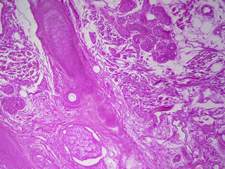 Microscope histology image of a hair follicle showing sebaceous and eccrine sweat glands (100x) - obrazy, fototapety, plakaty