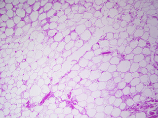 Microscope histology image of adipose tissue of the hypodermis (100x)