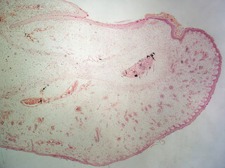 Microscope histology image of developing nail at tip of finger (40x)