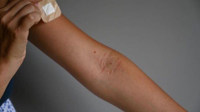 Young woman removing medical patch against gray background, close up