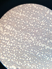photo of blood cells under microscope