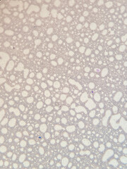 photo of blood cells under microscope