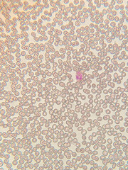 photo of blood cells under microscope