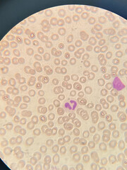 photo of blood cells under microscope