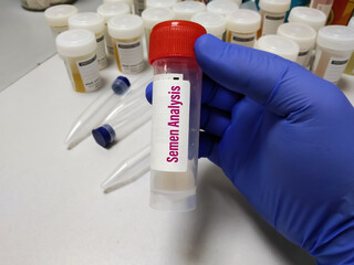 Semen analysis, sperm analysis doctor hold a container with semen sample for microscopic...