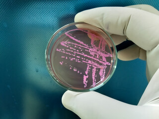 Bacteria colonies culture on selective agar media(SS agar) contains small light grains.Escherichia...
