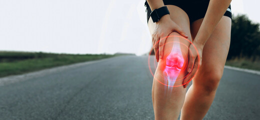  Joint  problems and tendon inflammation. Sporty woman who suffered a knee accident during the run.  
 - obrazy, fototapety, plakaty